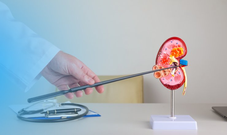 Kidney Health & Dialysis: A Complete Patient Guide